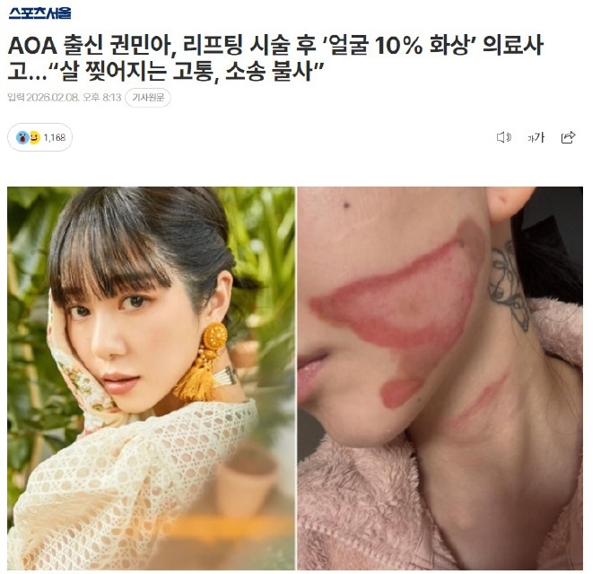 权珉娥做医美导致面度灼伤 据韩媒，权珉娥做了睡眠紧致提拉术，醒来后脸上皮肤撕裂般