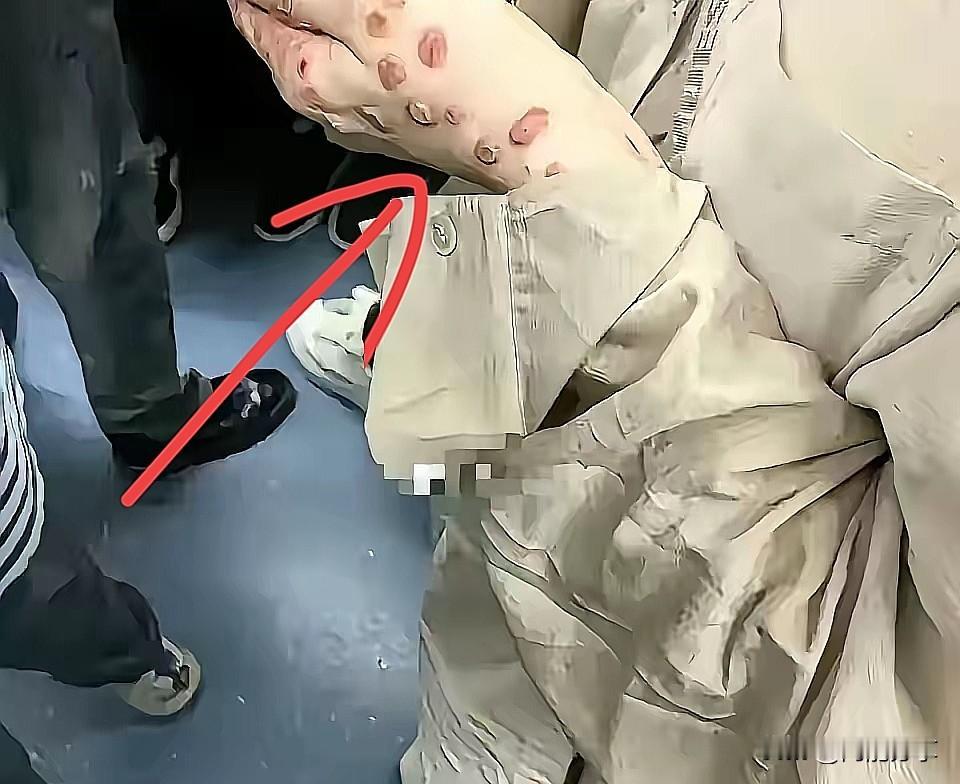 首先要明确，艾滋病的传播需要特定途径，日常接触如共乘交通工具、肢体轻微触碰等不会