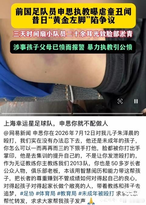 就算是中国足球比较古早的“教育方式”，也不会出现连续打二十几耳光的情况，不知道这