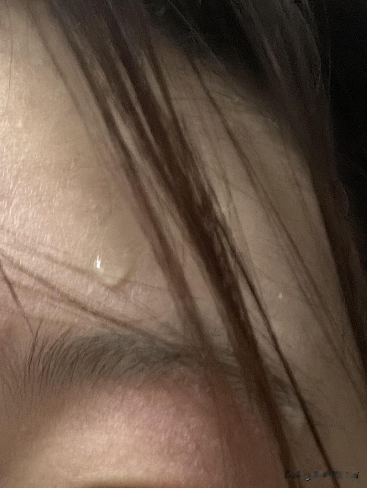 从便秘发现了自己真是个心态很差的人…
怎么会有人因为便秘导致有点类似于呼吸碱中毒