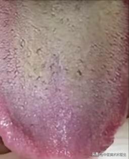 小伙子年纪轻轻就一身的毛病，可别再乱吃药了

患者主诉：平时容易胡思乱想，那方面