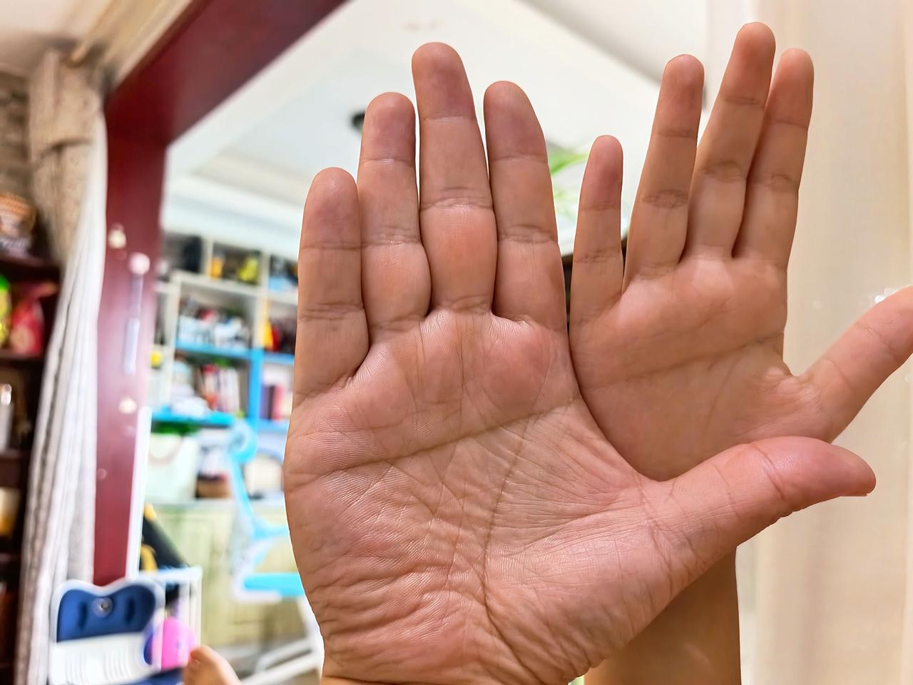 和儿子的掌纹是一样的。