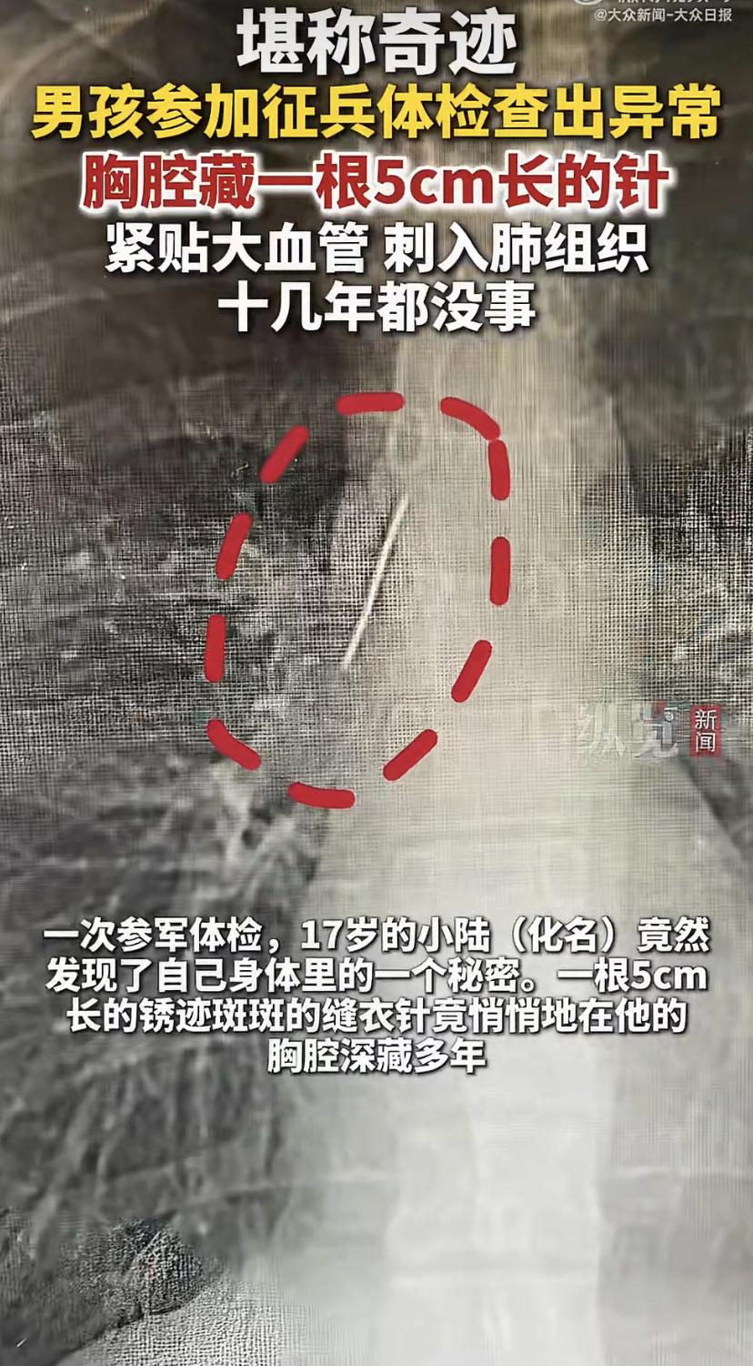 17岁的小陆去参加征兵体检，本以为就是走个过场，结果医生盯着CT片子看了半天，表