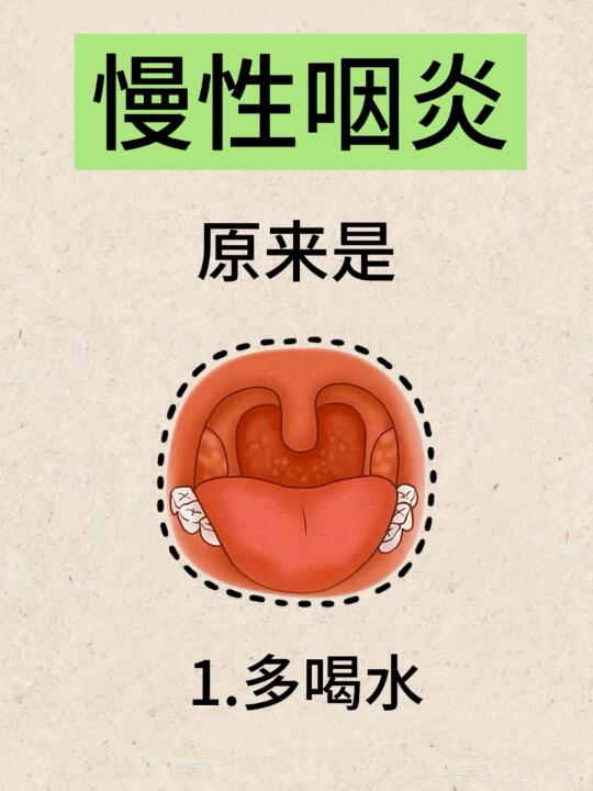 其实你的慢性咽炎已经很差了…