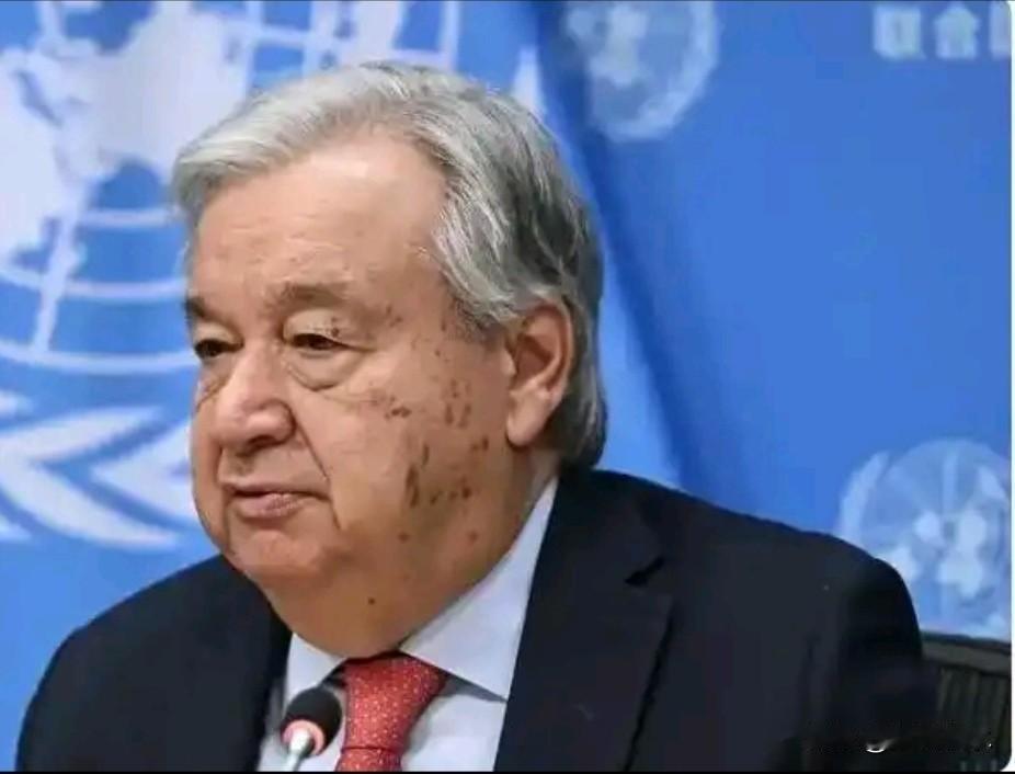 联合国秘书长古特雷斯在天津接受专访时，用罕见的明确与强硬，为一段历史盖棺定论：“