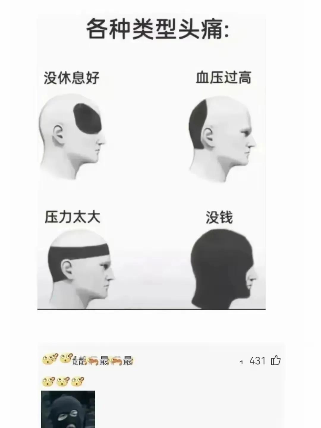 如果你是不是头疼，可以对照一下是什么原因