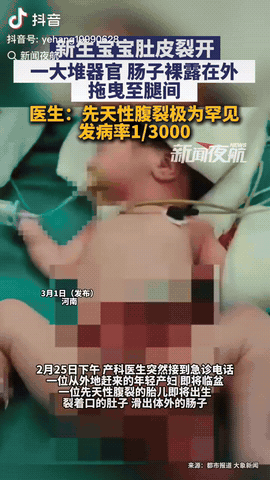 河南的一家医院里，产科医生接到一个十万火急的电话，电话那头称有个特殊情况的外地产