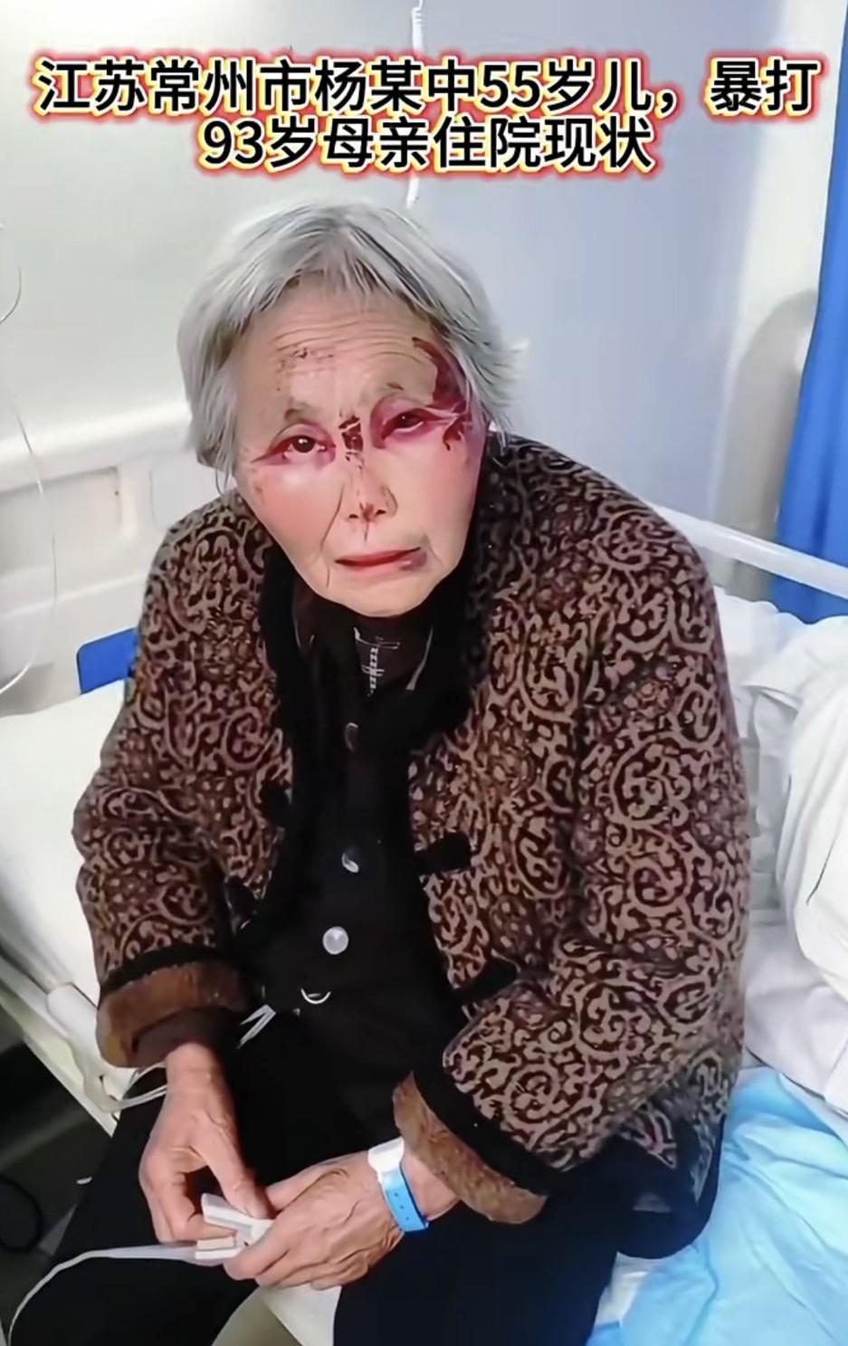常州老人遭儿子暴打进医院，

五个子女竟成养老窟窿，

监控视频掀惊天秘密。
