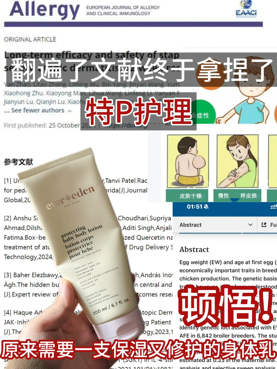 这个🏥研身体乳对付特敏皮包牛的！