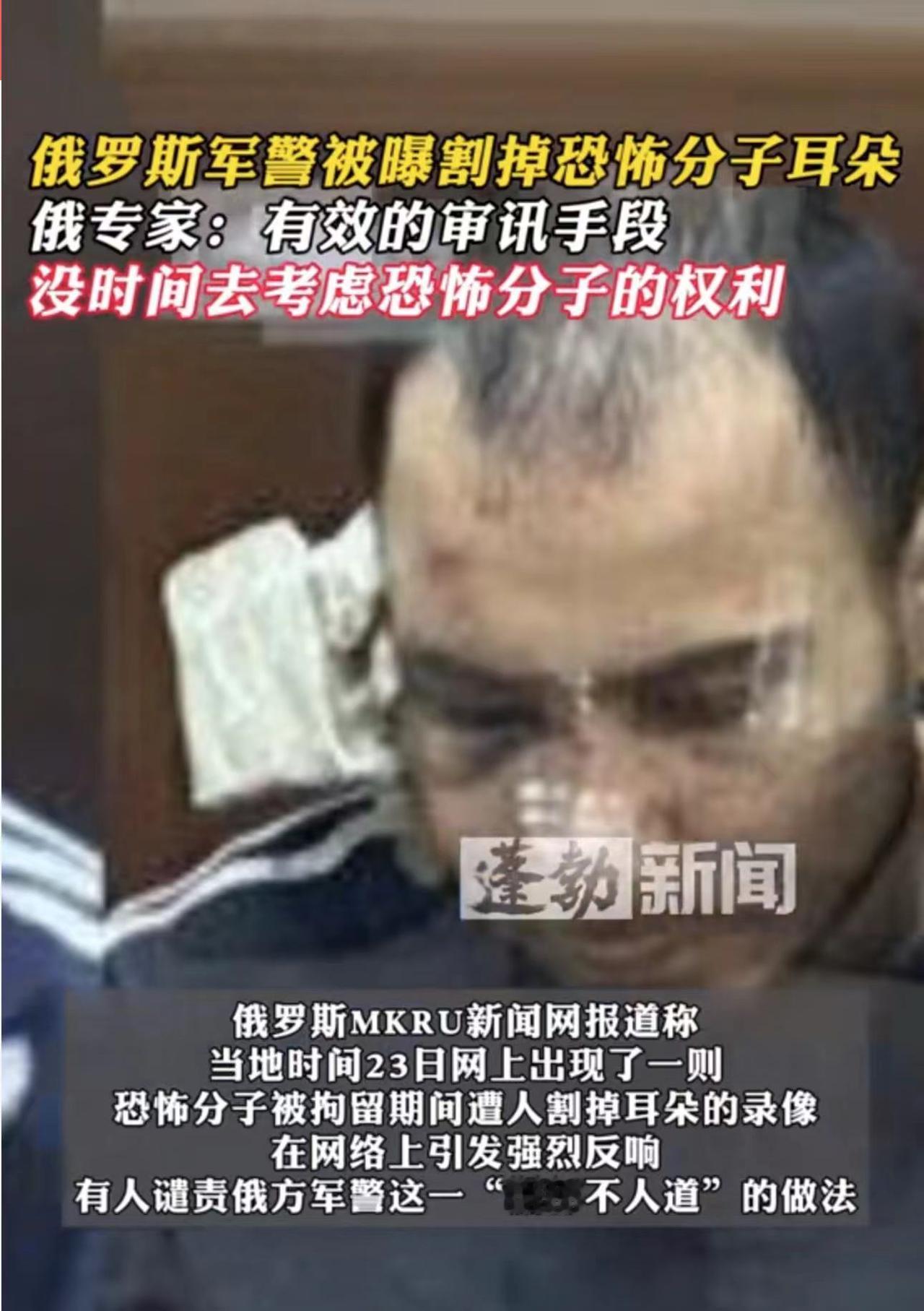 俄军警被曝审讯割掉恐怖分子的耳朵，有人谴责军警做法不人道
根据俄罗斯MKRU新闻
