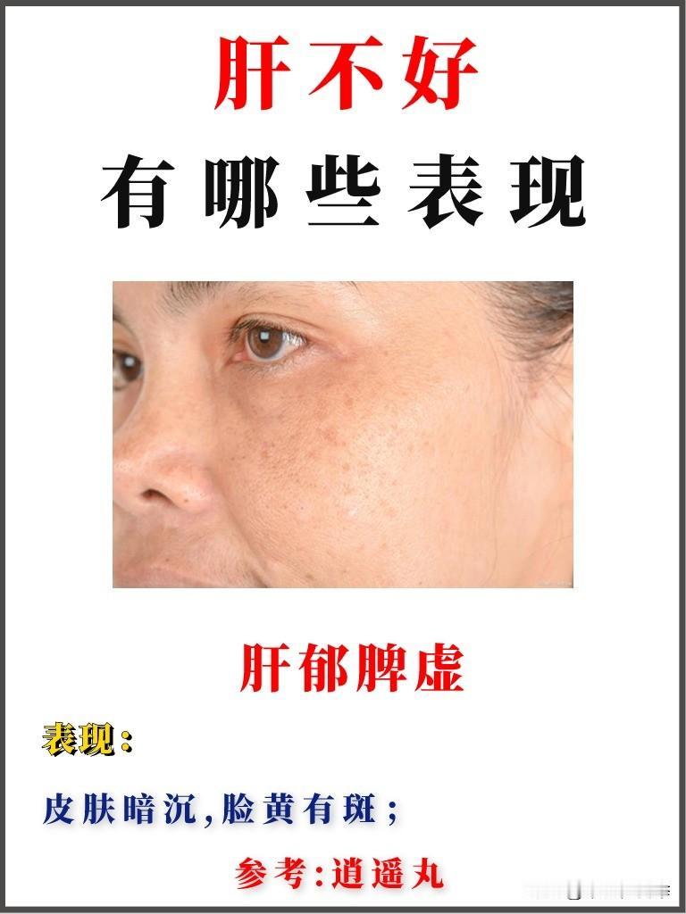 肝不好的人，身体这些变化是在给你提示
#中医##养生##肝#