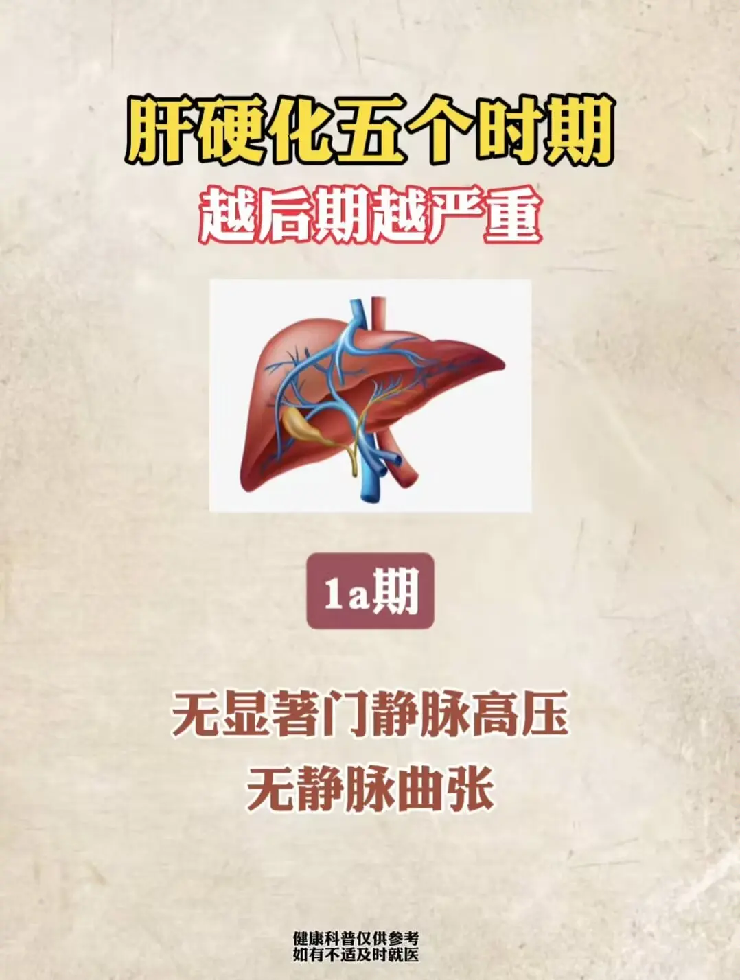乙肝 肝硬化 肝癌