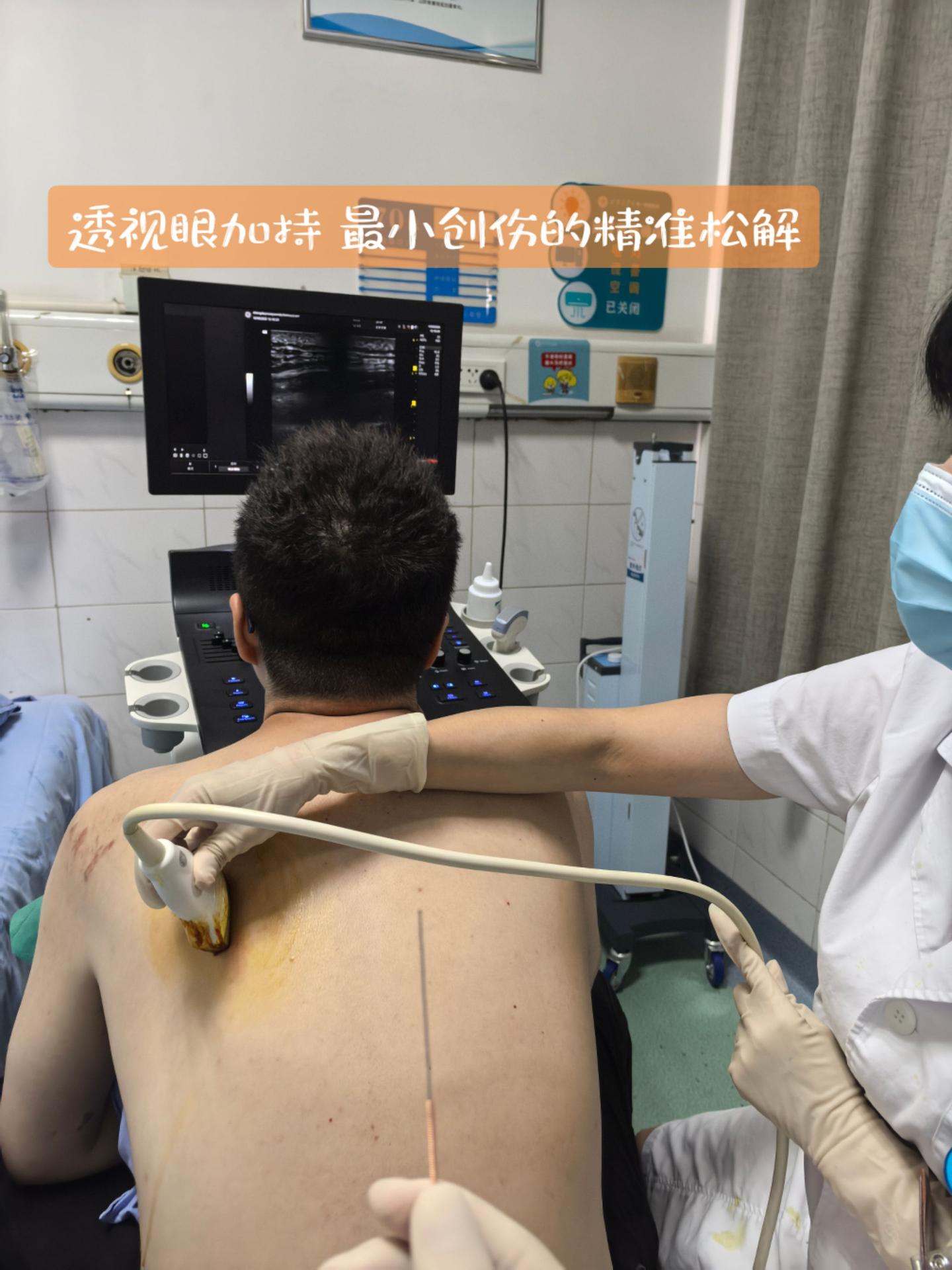 不小心看到了他的直播：“我看到我的肌筋膜正在被撕裂”—“疼吗？”—“不...