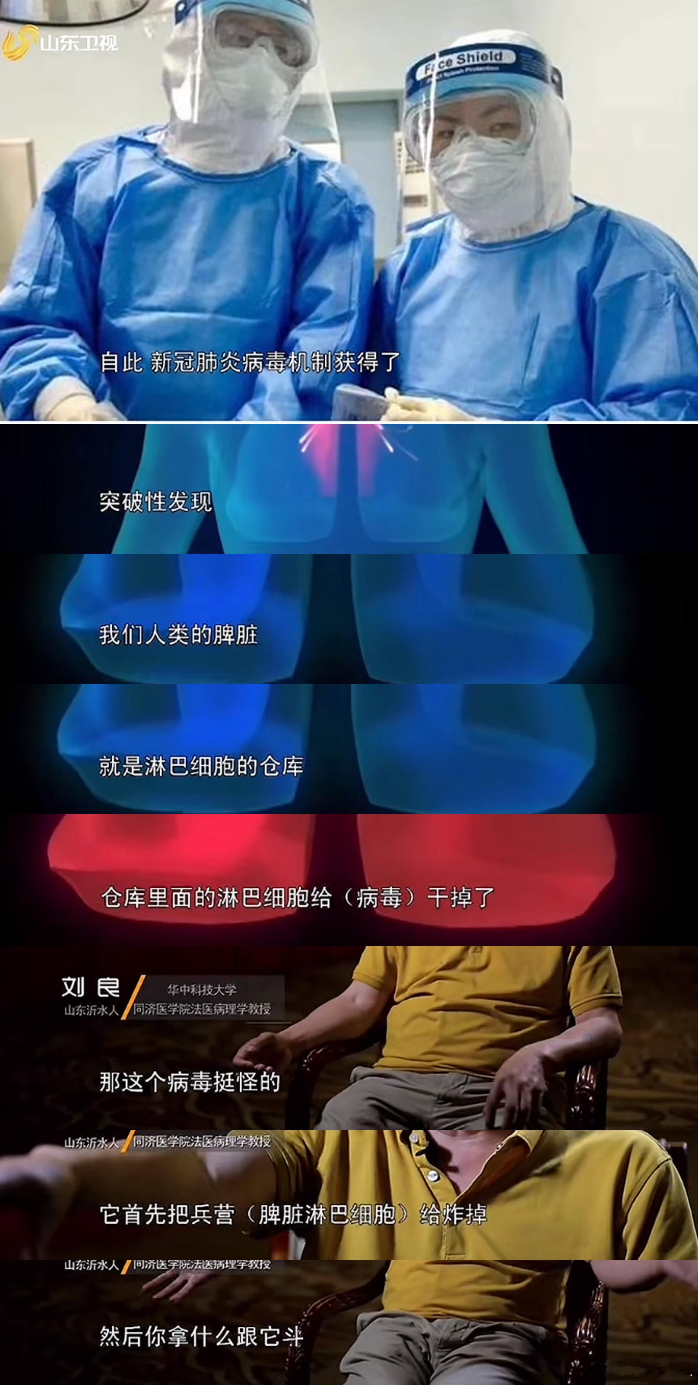 刷到老视频，第一位解剖新冠嘎病例的法医，对病理的描述。淋巴细胞都给病毒干掉了[柯