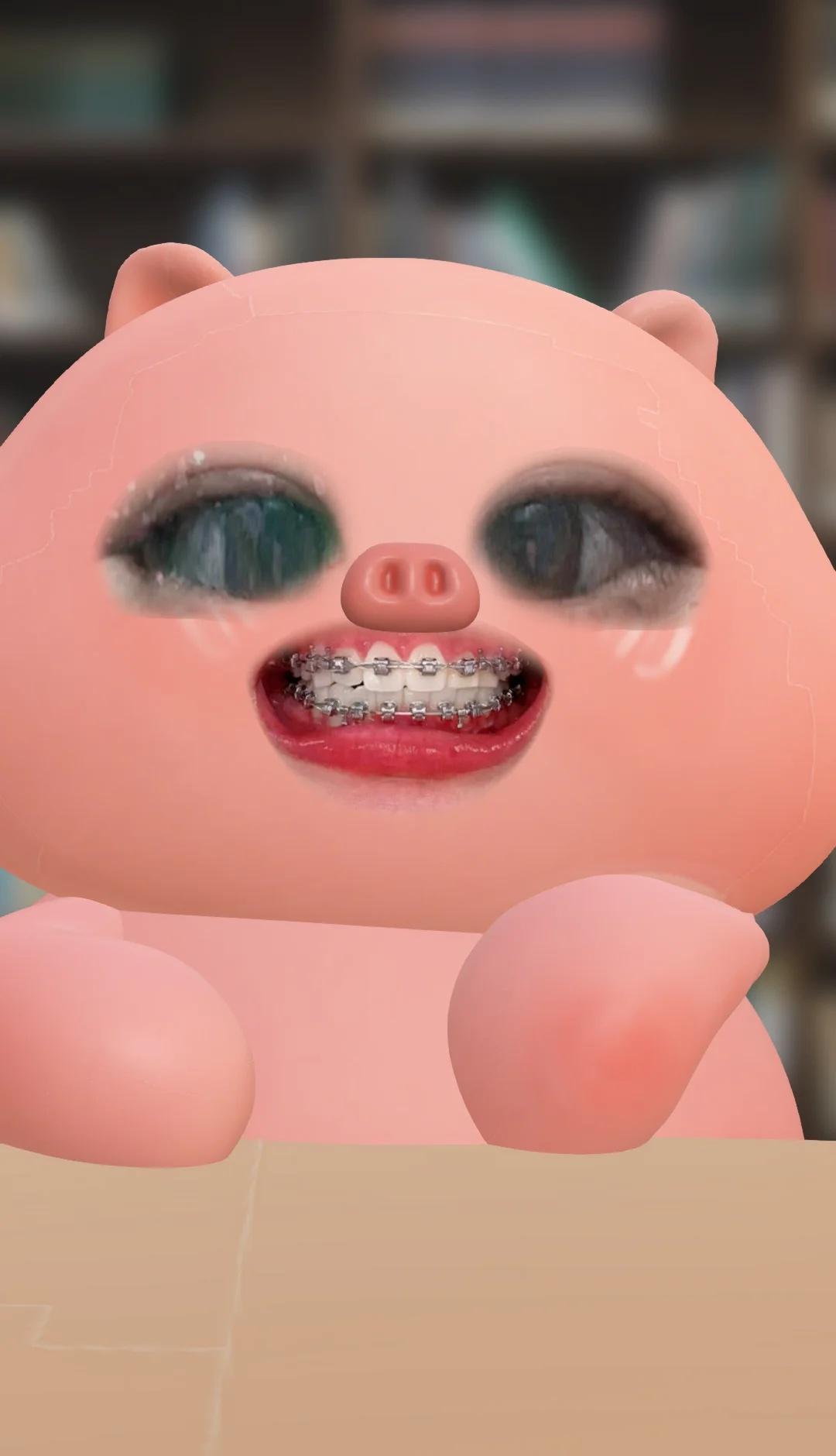 摘牙套倒计时一天！！！
我自己知道的问题就是下牙中线不齐，但还需要打骨钉矫正，我