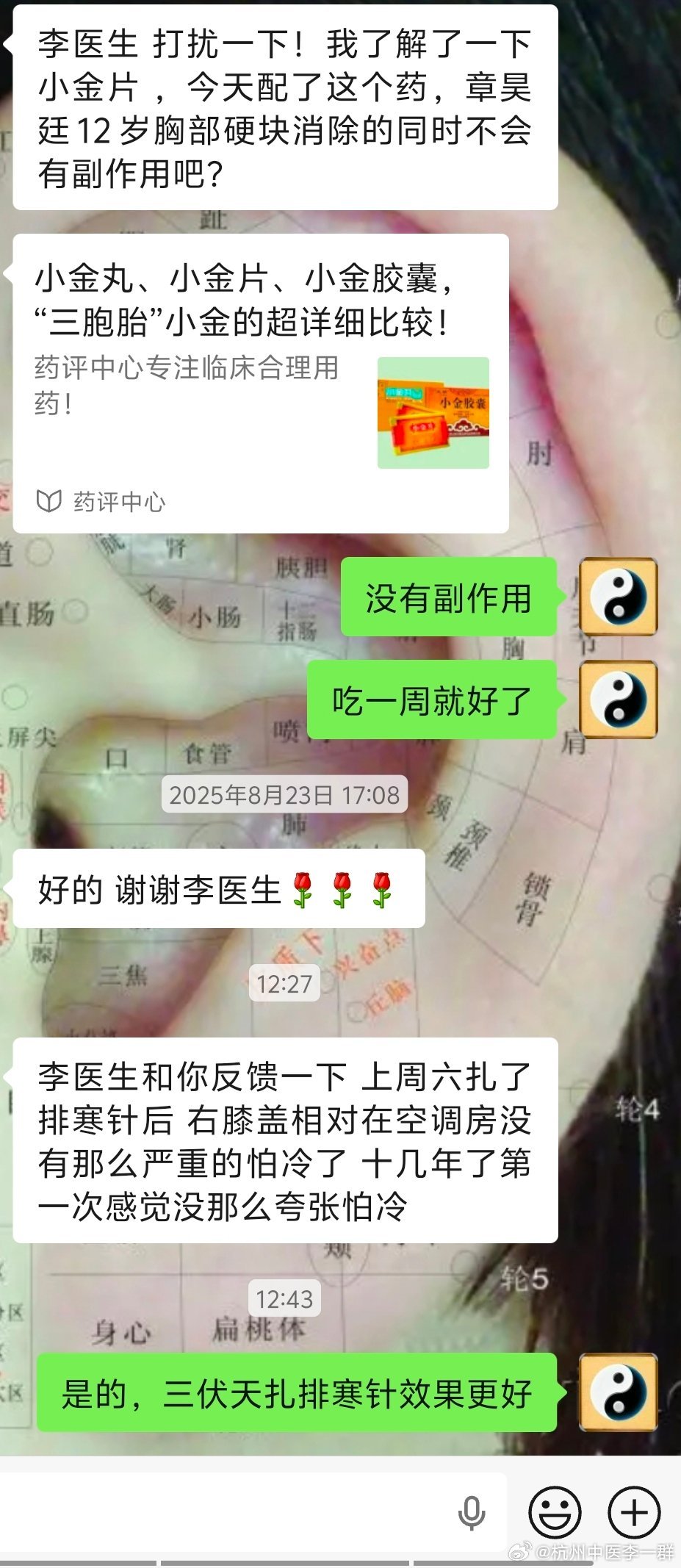 三伏天开始给一些老寒腿，各种关节怕冷的，脏腑虚寒扎排寒针配合艾灸点穴。不少反馈效