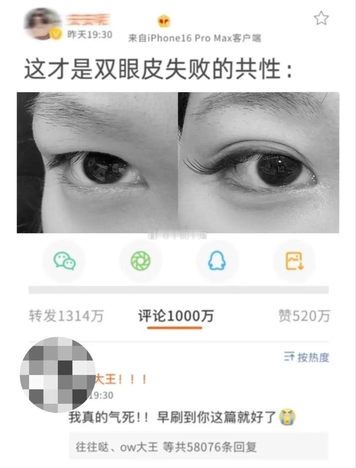 劝醒每一个冲动去割双眼皮的人！！ ​​​