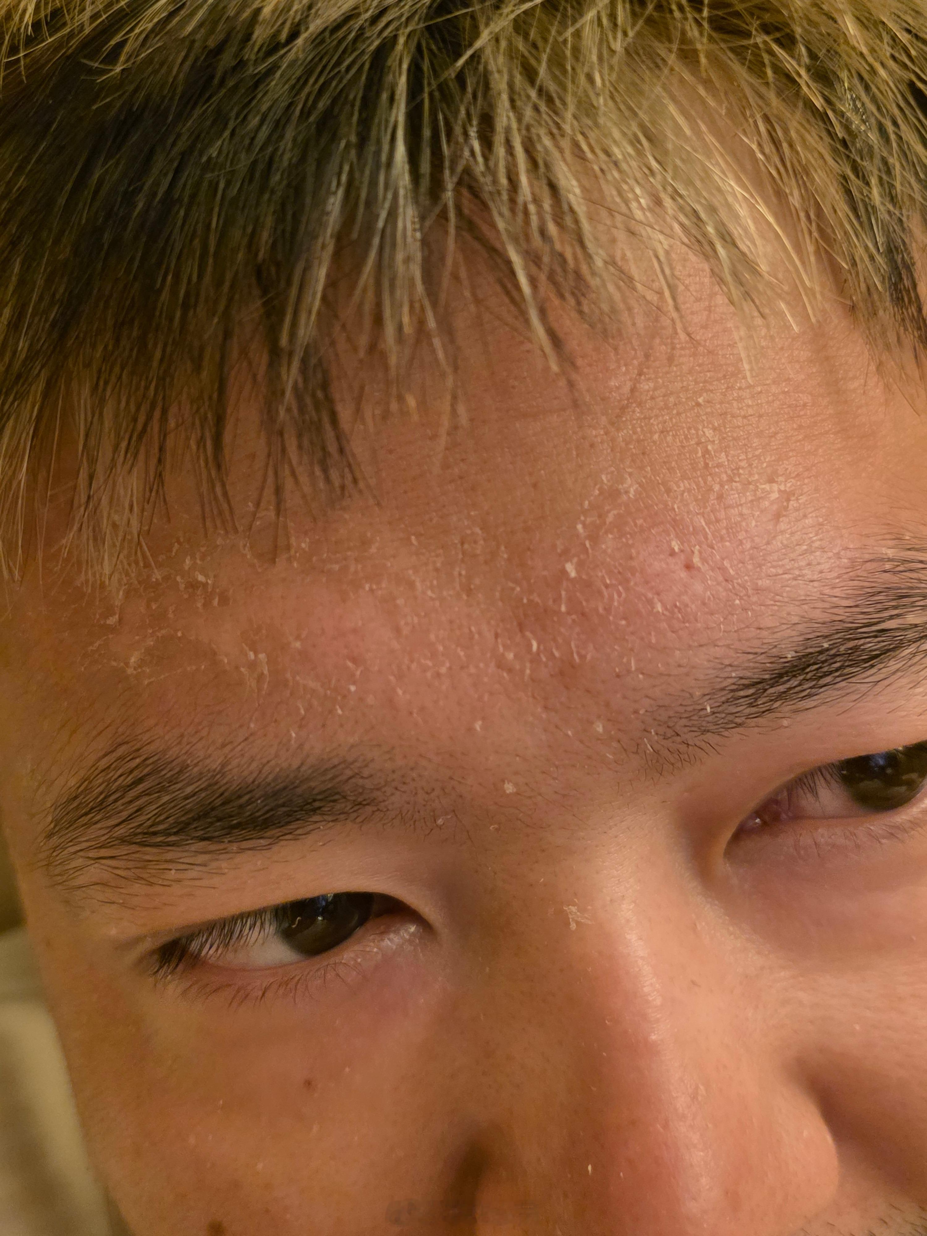 为何明明出生寒门 还晒成这样 ​​​