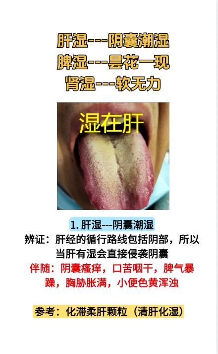 1.肝湿---阴囊潮湿；
2.脾湿---昙花一现；
3.肾湿---软无力#医学科