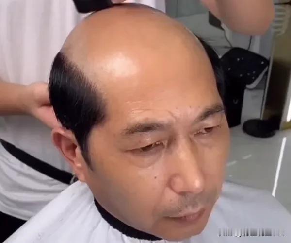 长不长寿，头发会报信？过了 50 岁，秃头的人更长寿？答案很意外

在生活中，我