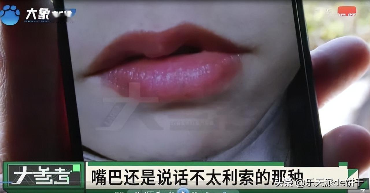 河南一女子为了更好享受夫妻生活，花6000元做了私密手术。可1个月后她却发现不仅