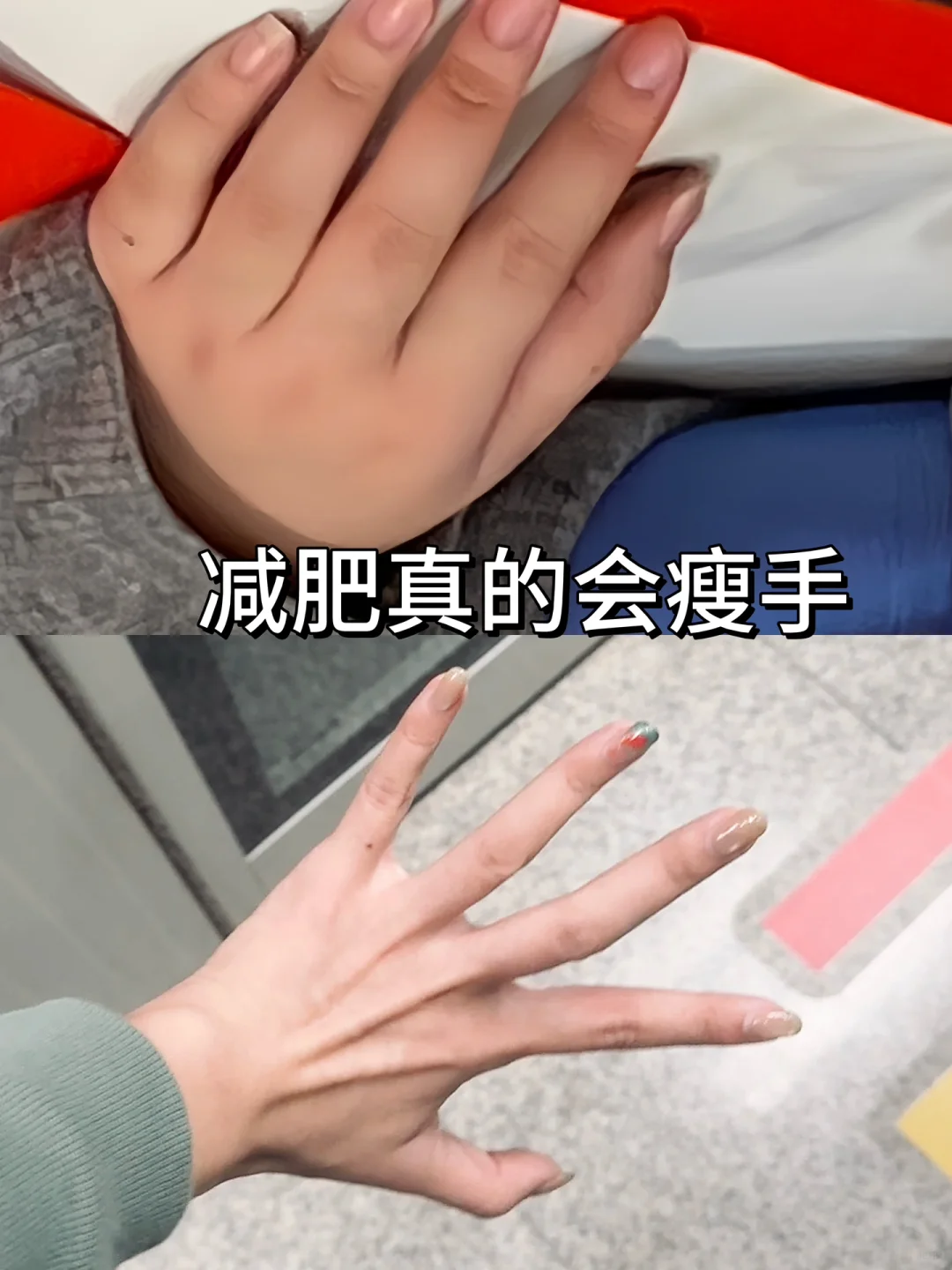 验证过了，减肥的确会瘦手
