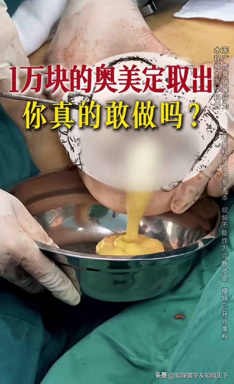 天啊，一些女人为了美，对自己狠起来比对敌人还狠！