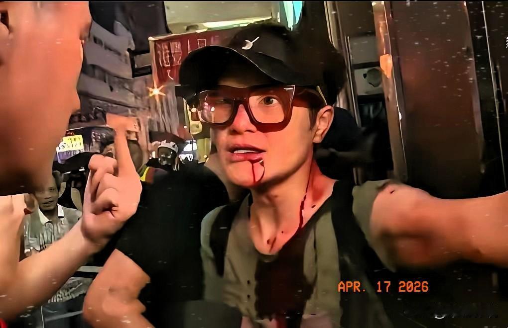 TVB那个演了一辈子丑角的马蹄露，这次把遮羞布扯下来了。
 
最近张敬轩摇身一变