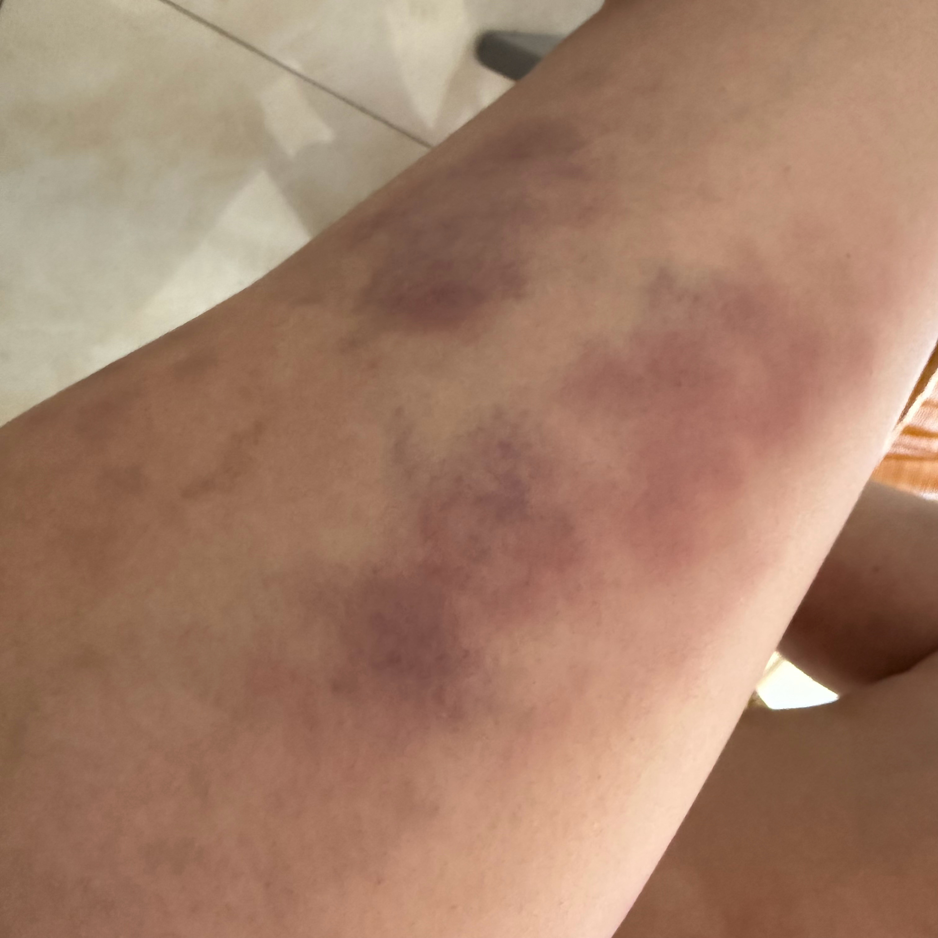 女人为了瘦腿对自己有多狠