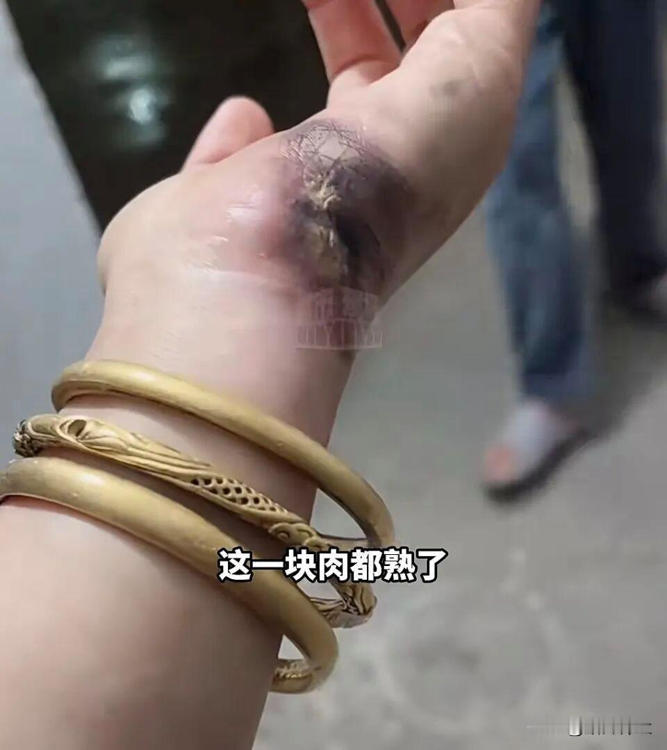 女子给电动车充电时，金手镯竟被电得破碎不堪，手也严重烧伤，这一意外事故背后隐藏着