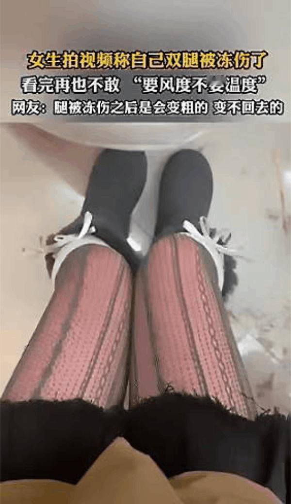 山东，一女子去威海海边玩，为了拍照漂亮些，她就穿了薄薄的一双丝袜去，没想到回到家