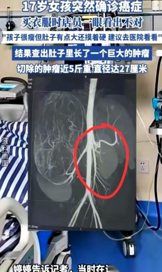 广东一个17岁的女孩，瘦得跟竹竿似的，试条裤子，腰那里却死活拉不上去。
她妈还在