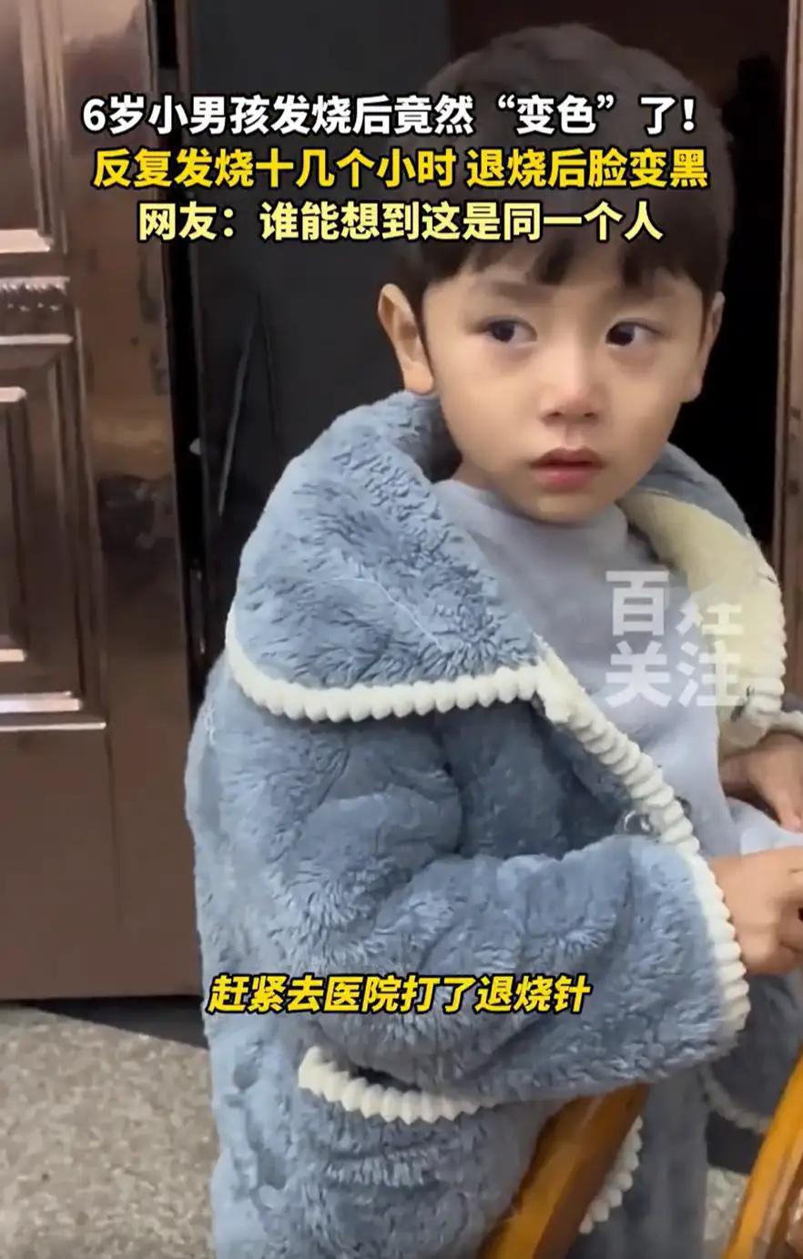 男孩发烧十几个小时 退烧后脸变黑

这则消息描述了一名6岁男孩突发高烧的经过以及