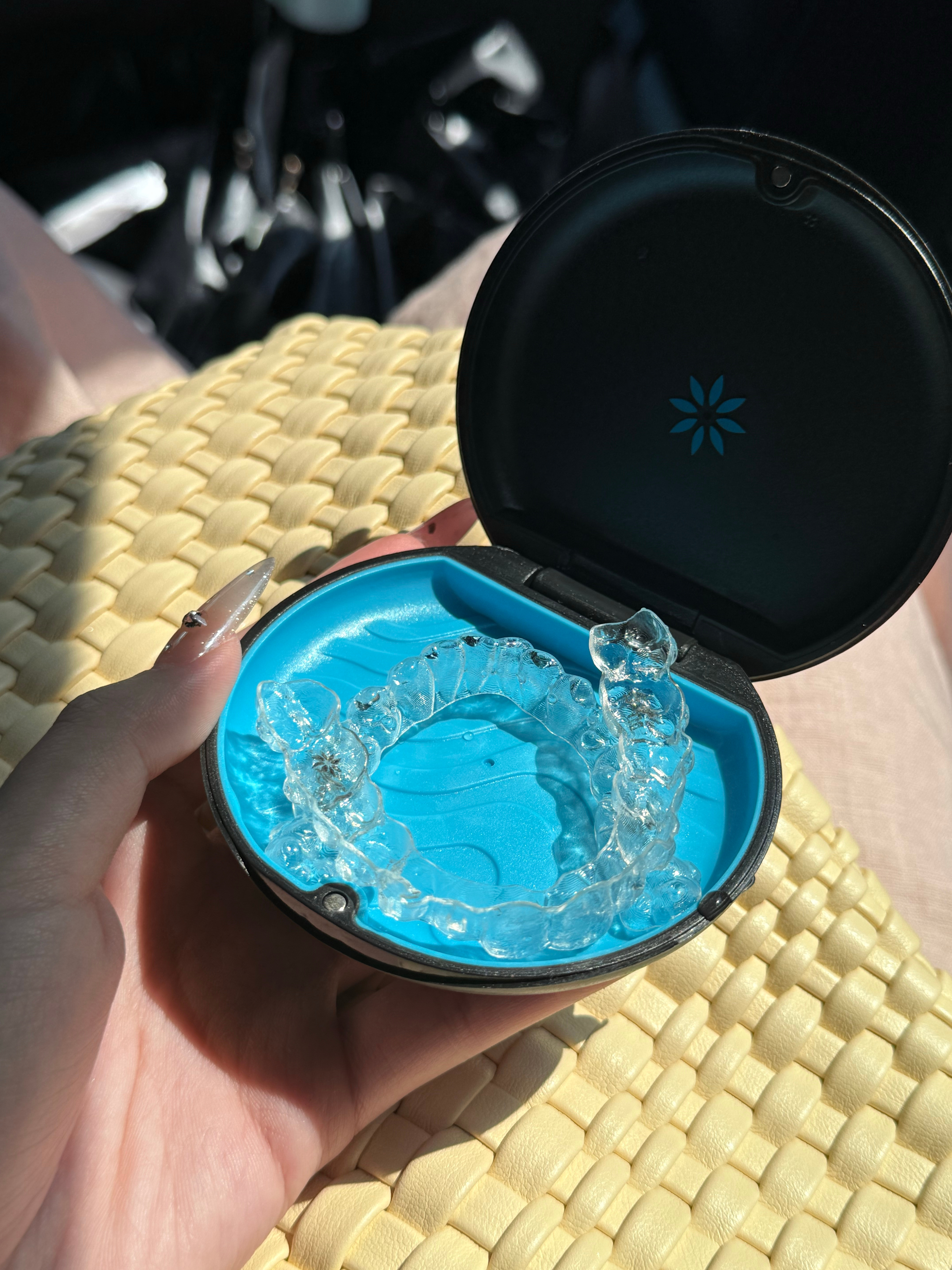 正式成为牙套妹 