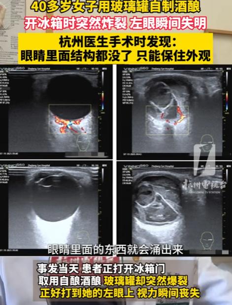 [微风]“太吓人了！”近日，浙江，一女子在家用玻璃罐自制酒酿，随后放进冰箱保存，