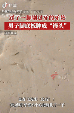 [太阳]悲剧还是发生了！广东深圳，一男子饭后用牙签剔牙，之后顺手把牙签一扔，一个