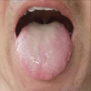 你才25岁，停手吧！小伙子，现在是嗨了，以后就悲哀[发怒][发怒]
主诉：时间越