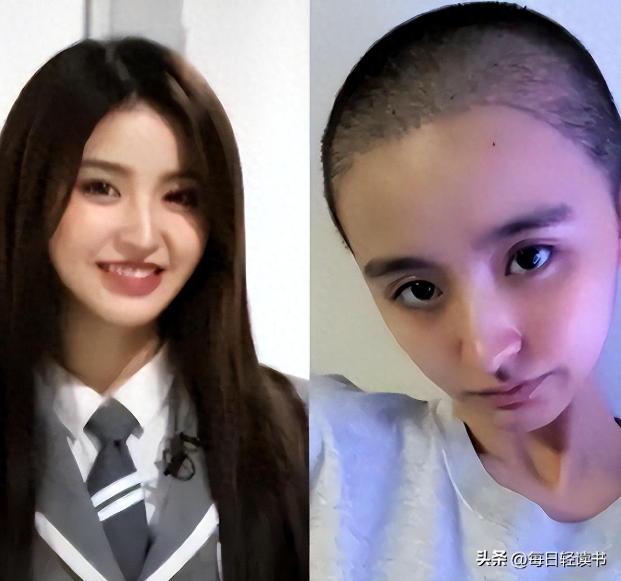 注射几十针不明液体，三年停经右耳长霉失聪，昔日选秀人气金子涵求助全网，圈内无一人