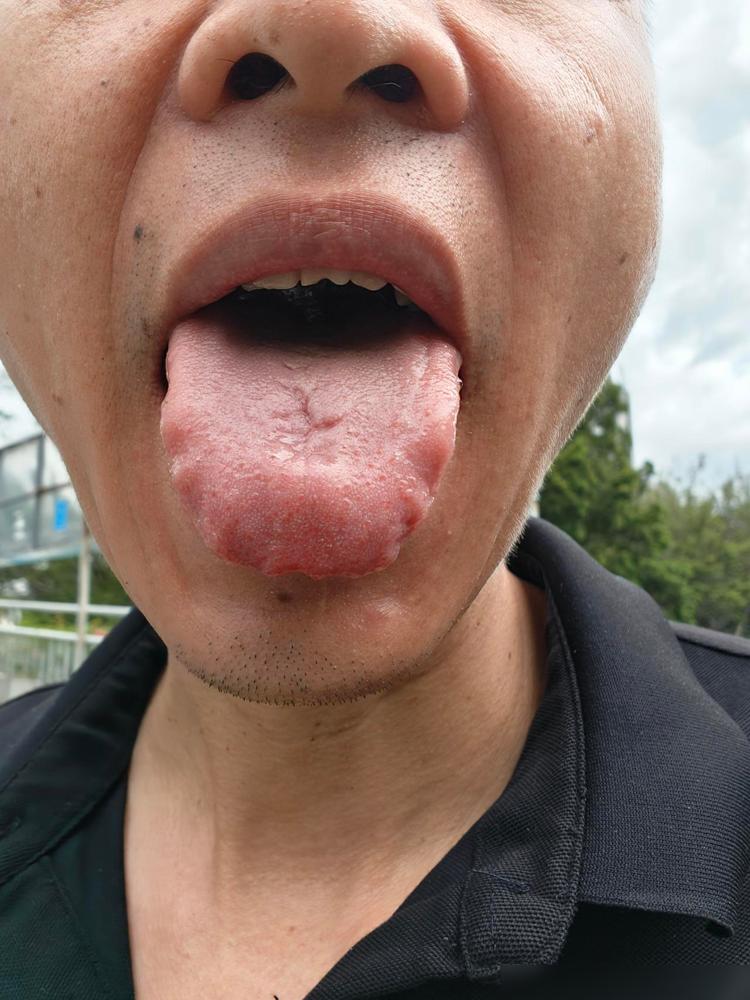 都说中医没落了，中药不治病，我的脾胃病终于快上岸了，中西医结合标本兼治，不是吹牛