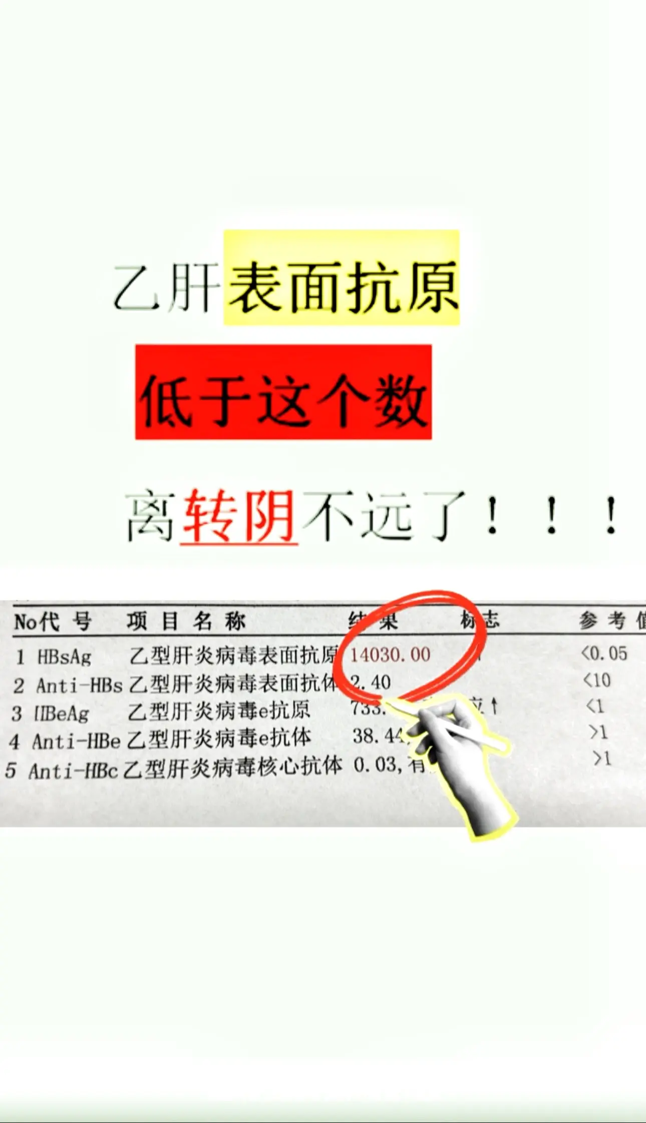 乙肝表面抗原是个关键指标，它的数值能帮我们判断离乙肝转阴还有多远。如果...