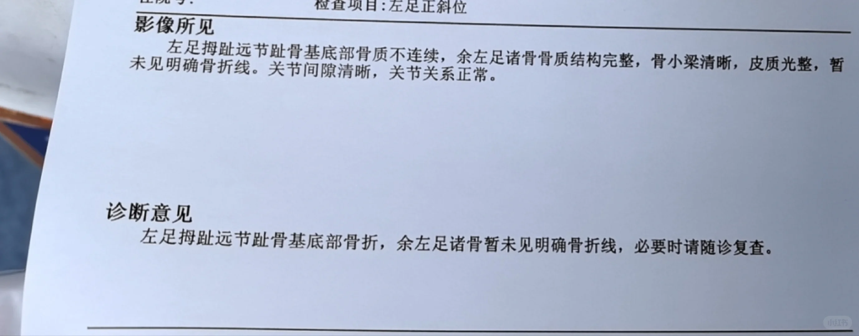 脚趾头骨折要全包固定吗？