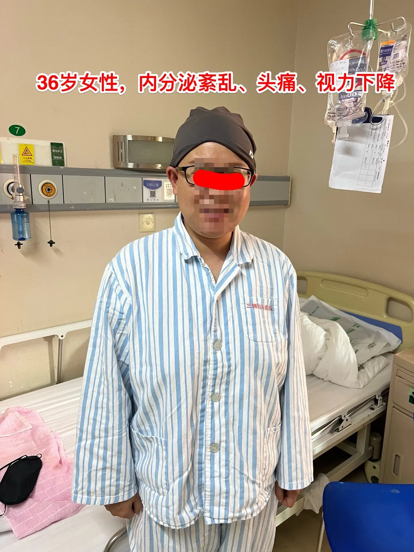 36岁玉溪市女性，颅咽管瘤手术后视力改善。一开始出现内分泌紊乱，随后出...
