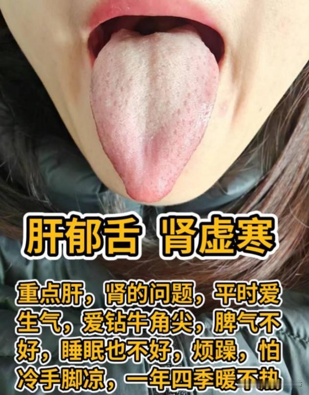 粉丝舌诊实战分享，你只要留，我就帮你分析！肝郁、湿热、脾虚、肾虚……你是哪里虚？