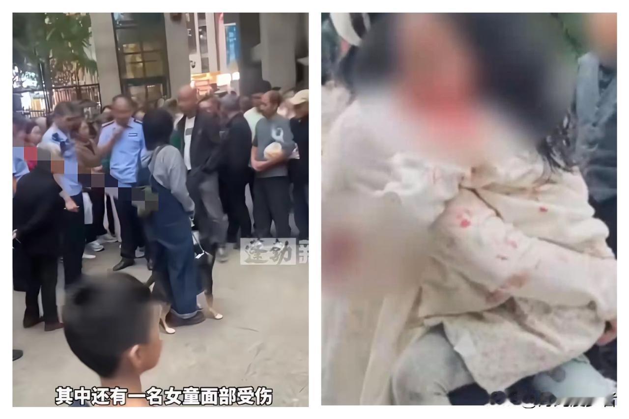 四川眉山牛头梗咬人事件
最让人想不通的，不是3岁女童被咬，也不是女狗主人没及时拴