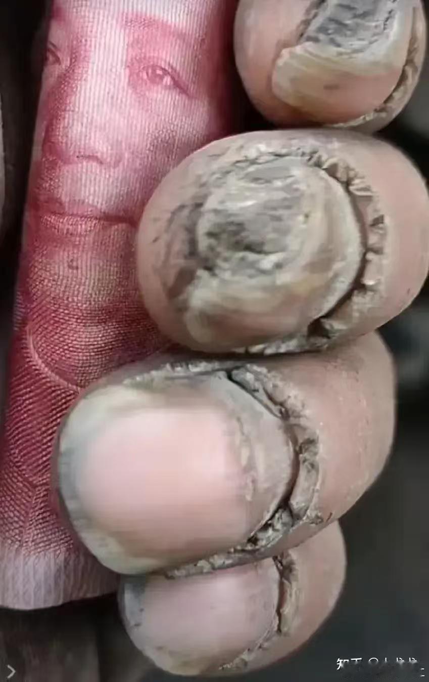 劳动与资本存在力不从心，教员倡导平等，但有时却事与愿违，干活干到精疲力尽，也不见