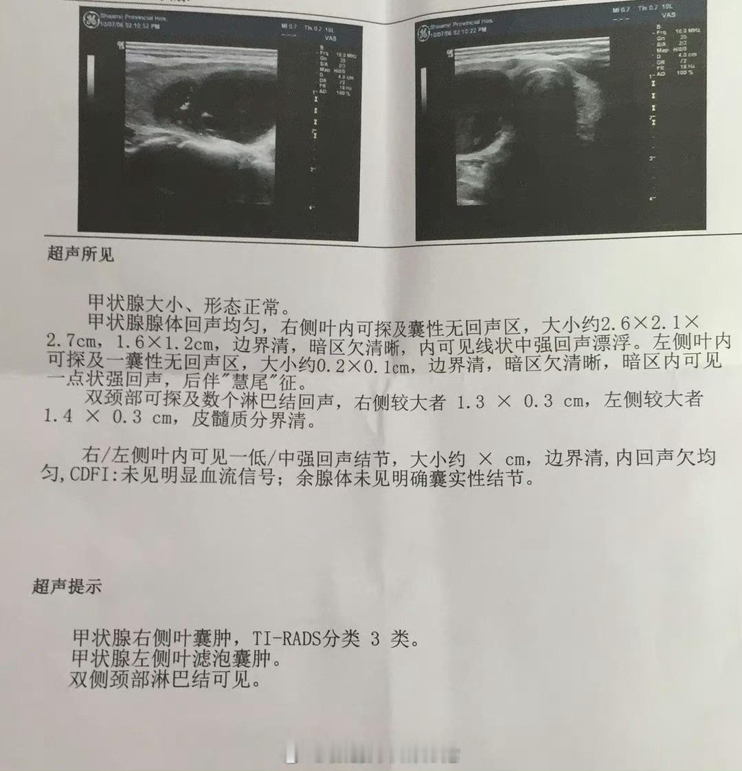 有个朋友的妈妈，朋友说每年不知道要往医院里填多少钱。她妈妈特别怕死，有一丁点不舒