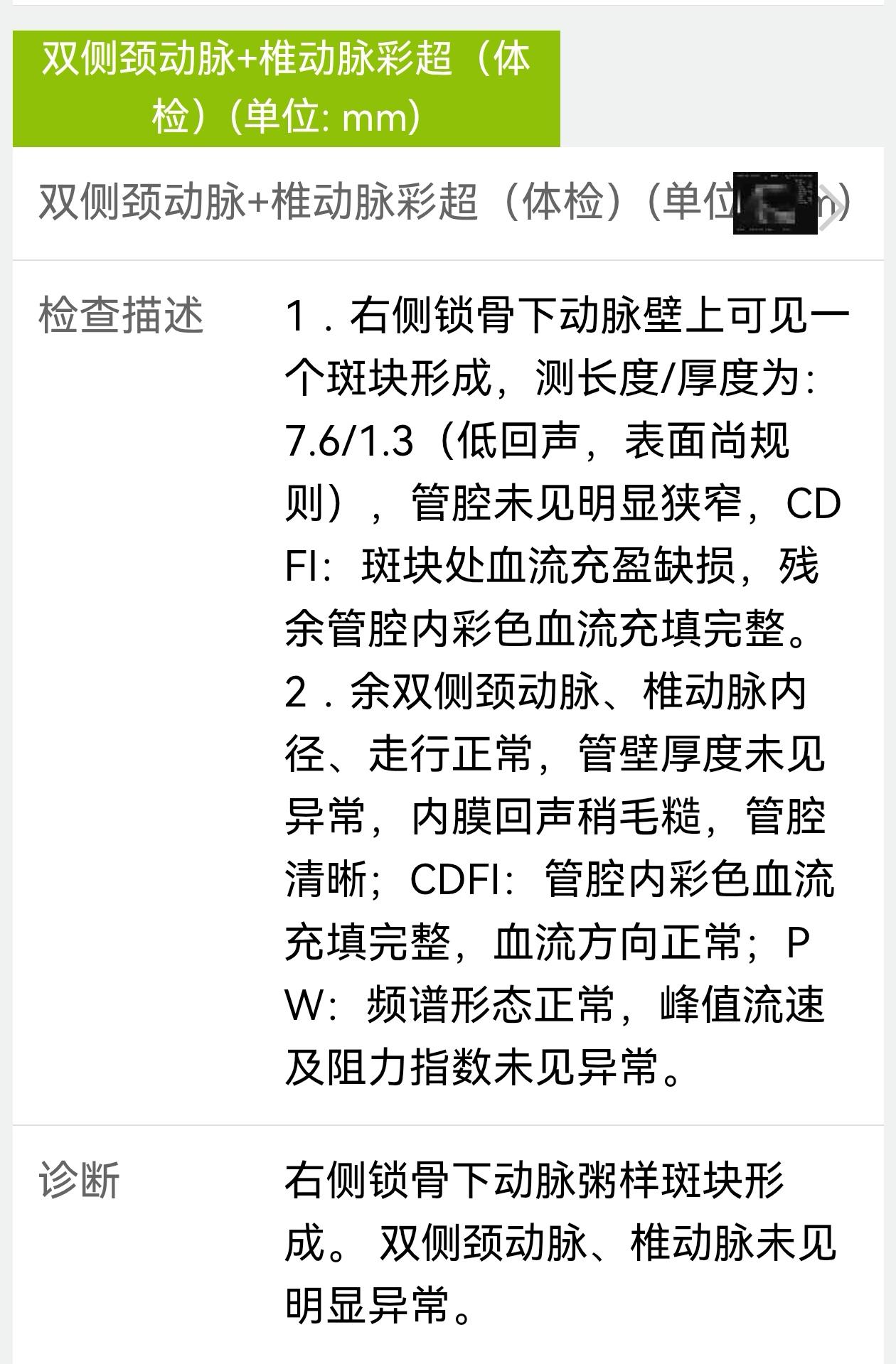 吃燕麦饭胸口会不舒服，怎么办呢？

我的低密度胆固醇3.09，锁骨那里有个低回声
