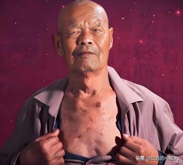 1956年，35岁的农民咳嗽10年，但却一直拒绝就医，一天，他突然用力一咳，一个