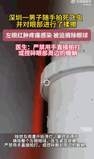 广东深圳，男子在家洗漱时随手拍死左眼下眼皮上的一只飞虫，还揉了揉眼。短短几小时后