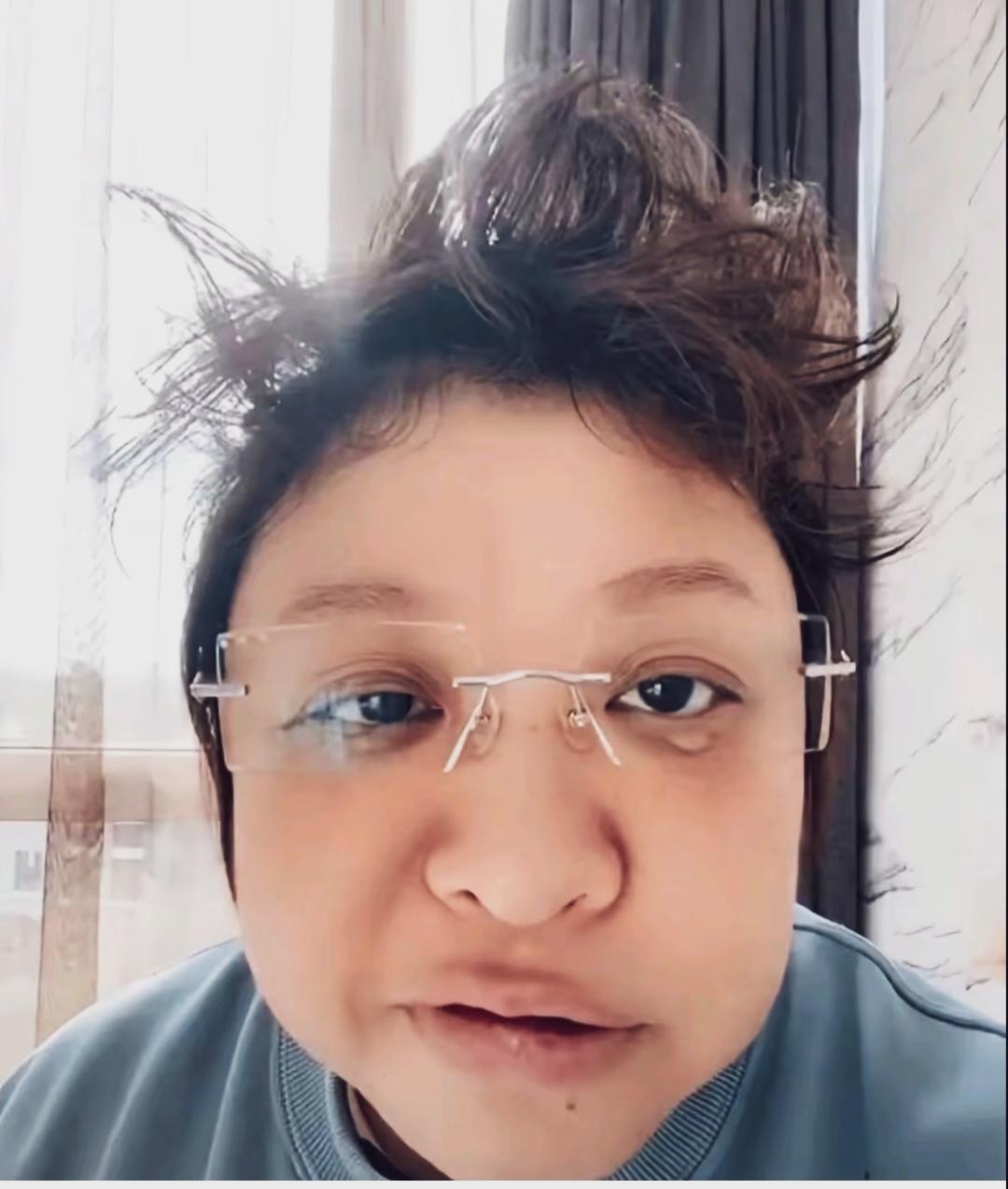 韩红素颜自拍，头发凌乱，黑眼圈明显，嘴巴干裂，明显是劳累过度。